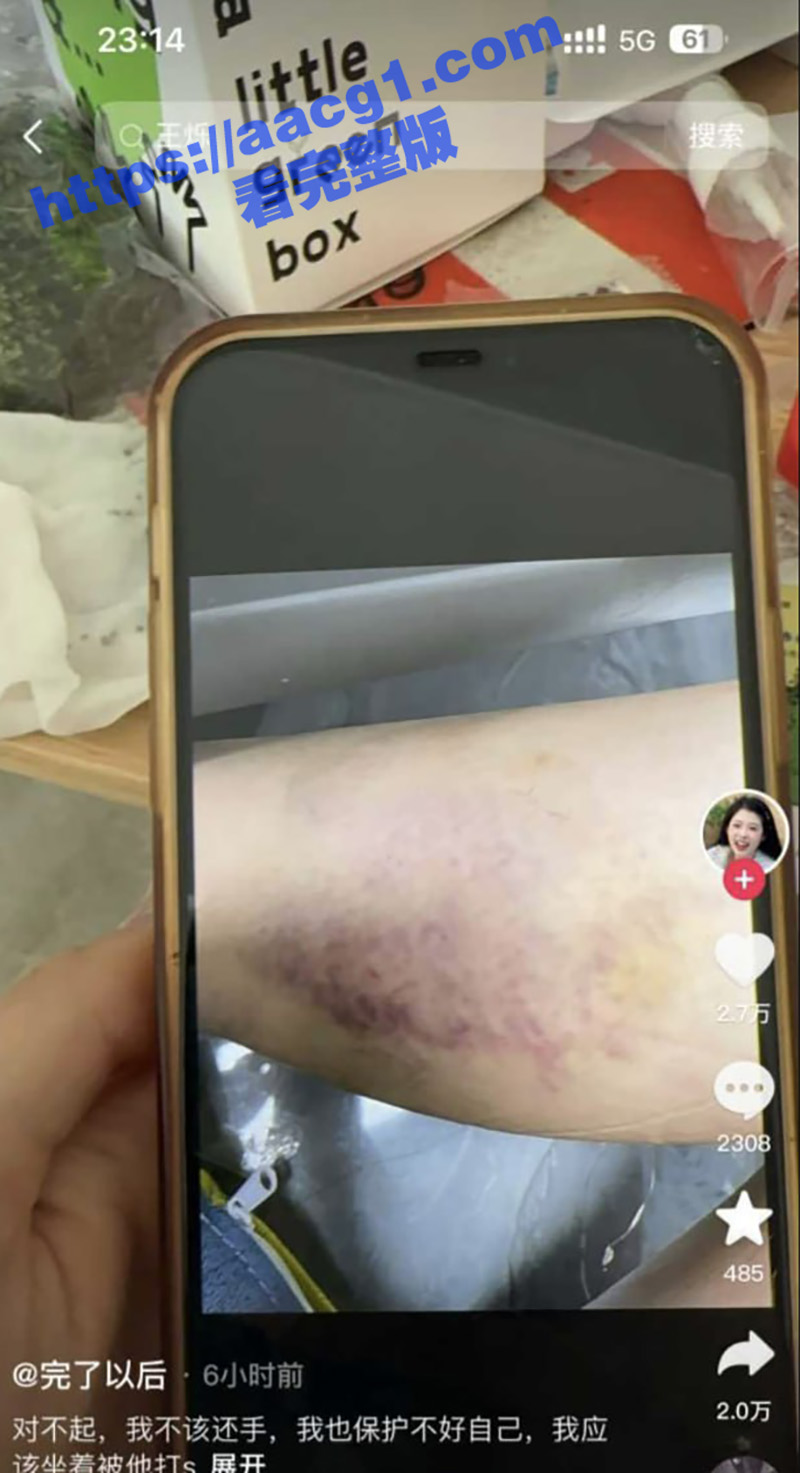 抖音网红王烁家暴事相关图片
