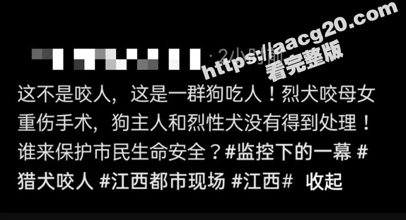 江西赣州母女被恶犬撕相关图片