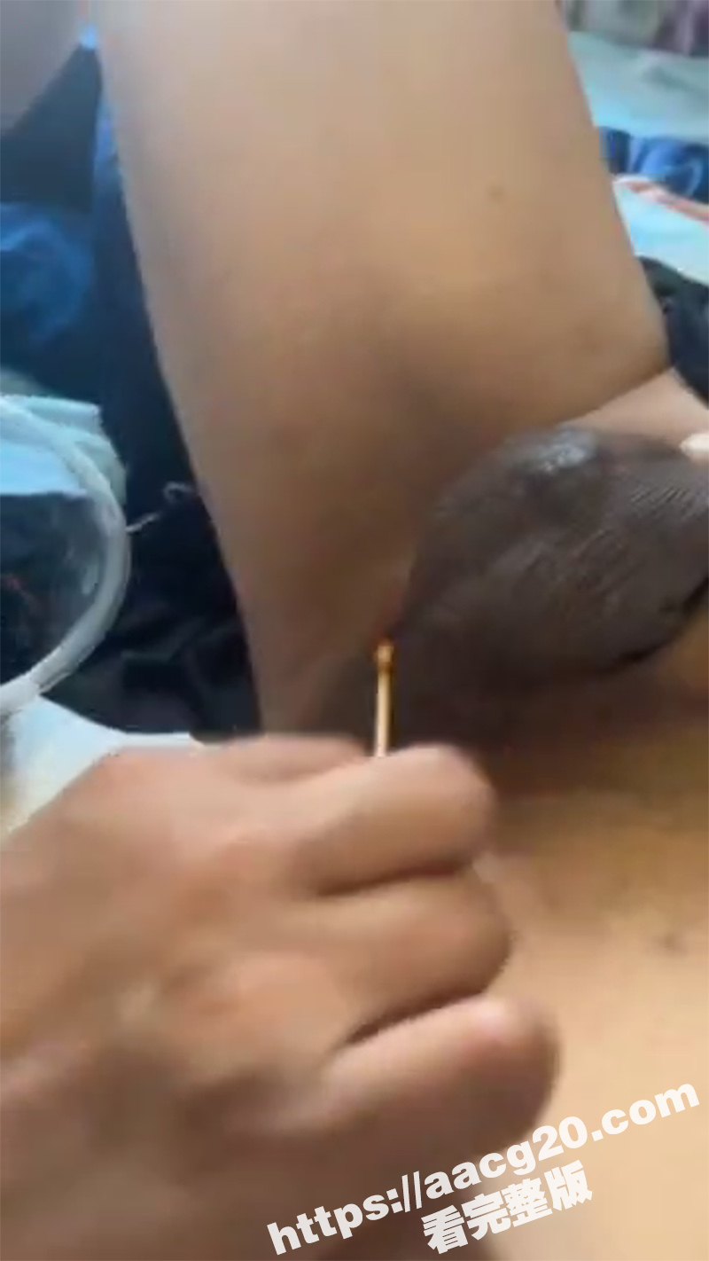 变性手术后真实画面 切屌变穴彻底成女人 连奶子都做出来了 消肿后还真是真假难辨啊