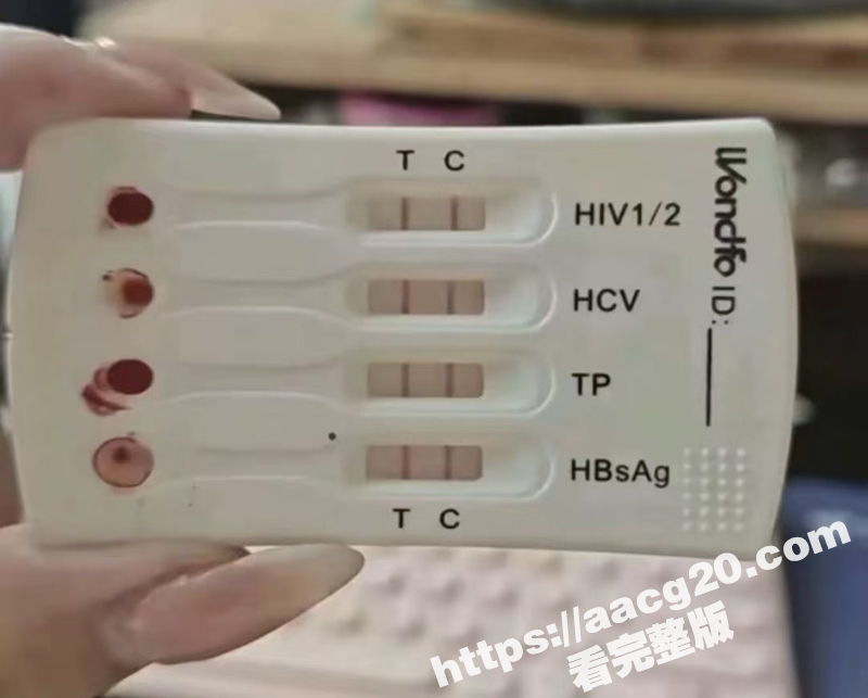 高颜值艾滋女报复社会相关图片
