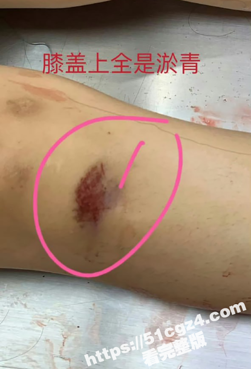 辽宁大连普兰店女孩 相关图片