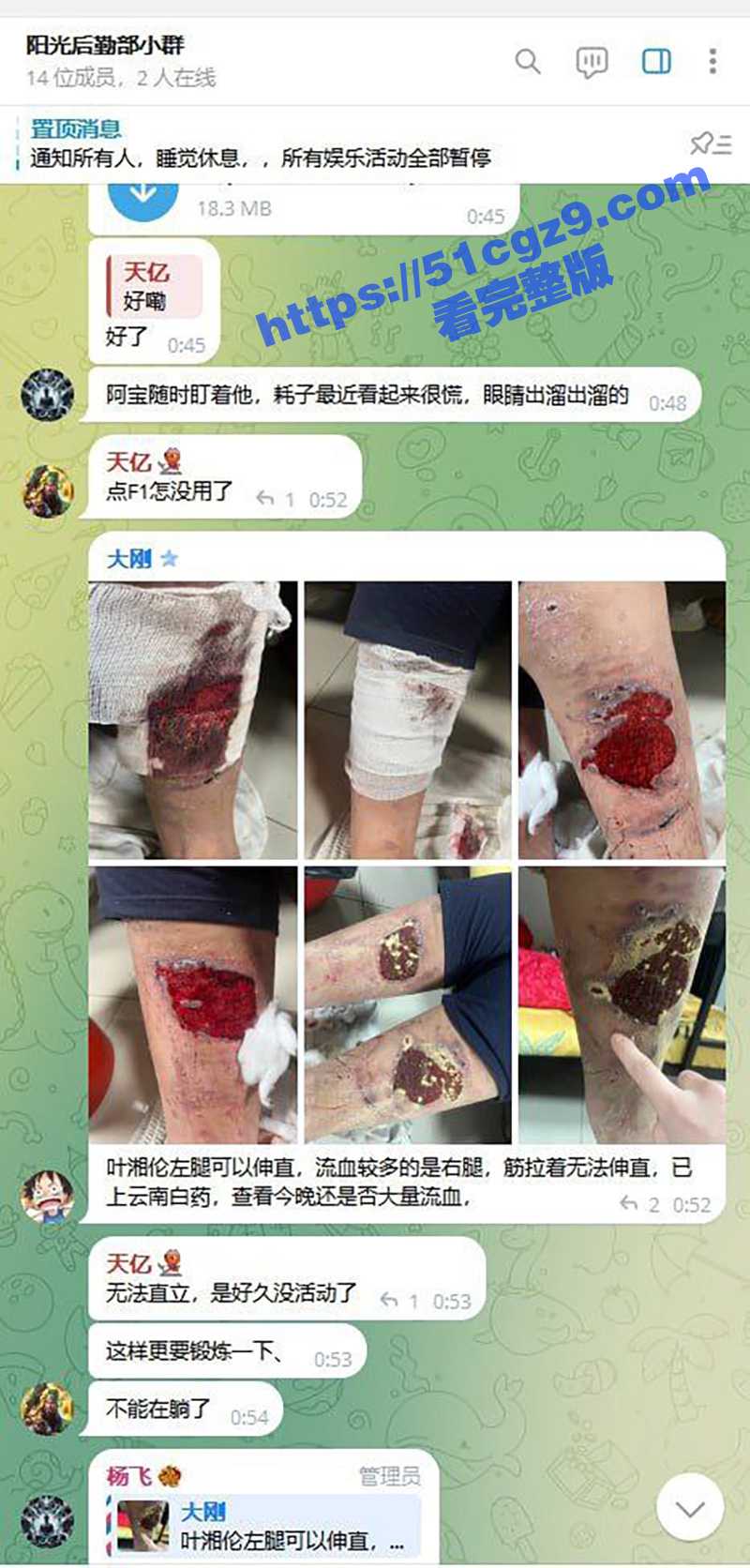 缅甸妙瓦底阿波罗园区阳光集团打死人后续 普京大帝直接霸气喊话犯罪份子！