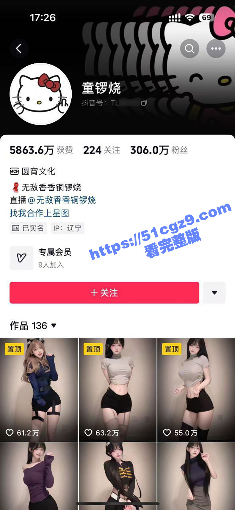 抖音尤物网红通锣烧 魅惑身姿反差嫩妹 细腰长腿性感撩人 微密圈大尺度套图 付费资源免费看