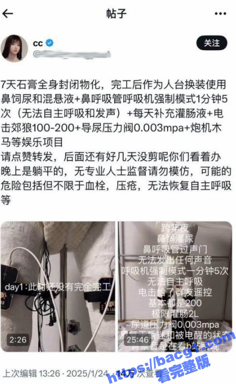 史上最炸裂猎奇佳作！7天石膏全身封闭物化 自动炮机24小时抽插不停 呼吸喂食全用管道！
