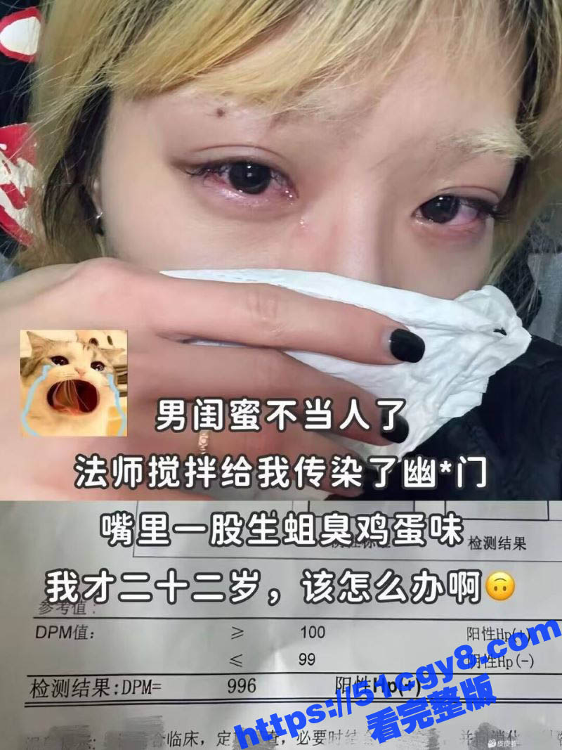 22岁美女惨遭男闺蜜偷袭爆肛 之后直接口交导致感染幽门螺杆菌 在线求助该怎么办 真是炸裂啊！