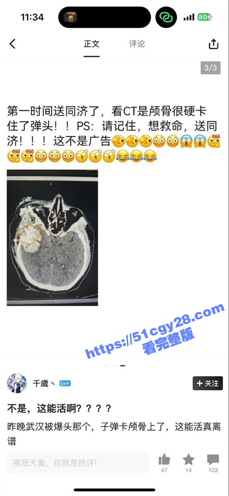 武汉枪击案后续4