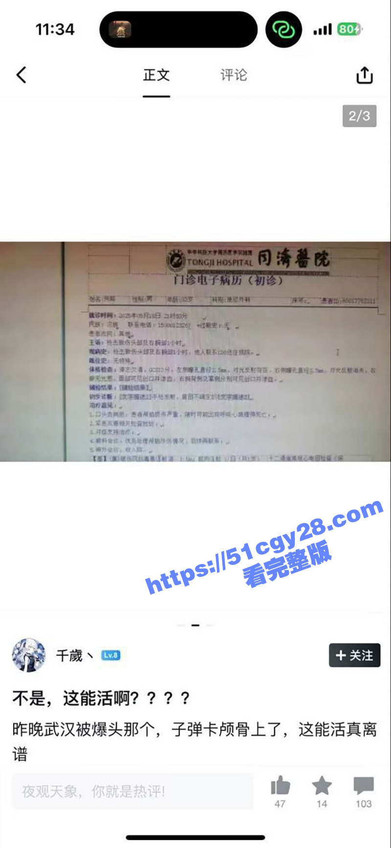 武汉枪击案后续5